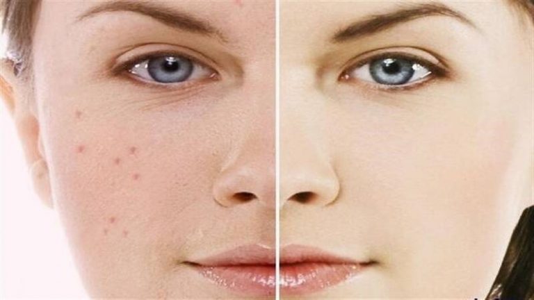چگونه از طریق رنگ پوست میتوان به نوع بیماری پی برد؟