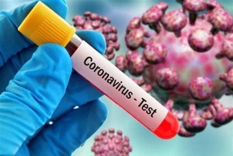 تشدید نظارت بر اجرای پروتکلهای بهداشتی در ورزش