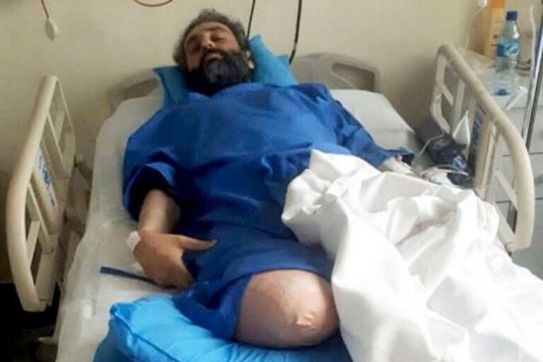 پس از گذشت یک سال؛ عامل اصلی تیراندازی به محیط بان گتوندی بازداشت شد – خبرگزاری هرانا